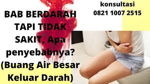 Doktersehat | © 2021 pt media kesehatan indonesia. Bab Berdarah Tapi Tidak Sakit Apa Penyebabnya Buang Air Besar Keluar Darah Youtube