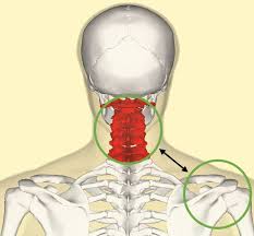 How to use cervical in a sentence. Articulos Sobre Patologias De Espalda Y Columna Blog Premium Madrid