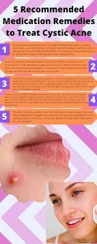 5 Recommended Medication Remedies To Treat Cystic Acne Treating Cystic Acne Cystic Acne Acne