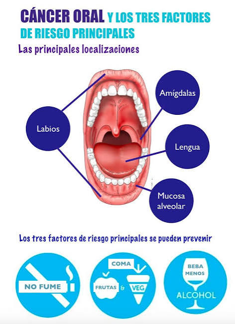 Cáncer Oral. - Clínica dental en Murcia Dávalos & Balboa
