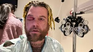 Fundraiser by Kimberley Durham : Help terry after losing his right eye!!