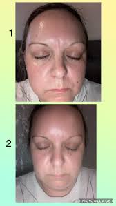 This is my review and I forgot to take side view before pick 🙈 however u  can see 1 before and 2 after