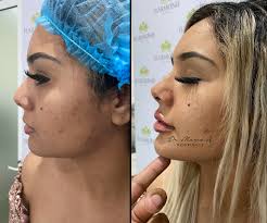 Harmonii Medical Spa