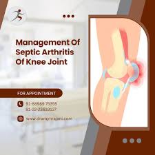 Image result for Septic Joint