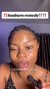 Does Nisa Lovely Gold Face Cream Clear Sunburn