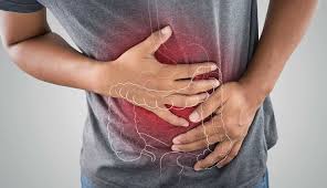 But some people with colon polyps experience: Symptoms And Major Causes Of Bowel Cancer Lifeberrys Com
