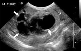 Ultrasonography Of The Urinary Tract Kidneys And Ureters Today S Veterinary Practice