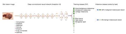 According to the american cancer society, just over 100,000 new cases of skin cancer are diagnosed in the united states each year. Dermatologist Level Classification Of Skin Cancer With Deep Neural Networks