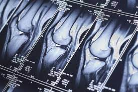 These orientations are then translated into images we can use for diagnosis. How Long Does A Knee Mri Take Aica Orthopedics