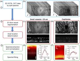 Professor ranjit rye, the member of the octa research group, warns the explosion of delta variant infections in the country is not a. Osa Visible Light Optical Coherence Tomography Angiography Vis Octa Facilitates Local Microvascular Oximetry In The Human Retina