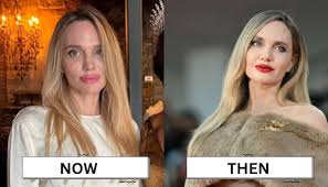 Angelina Jolie's recent appearance sparks health concerns mixed with plastic surgery allegations