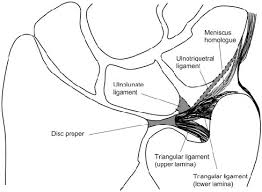 Difficult to diagnose with history and physical exam. Schematic Drawing Of The Tfcc Download Scientific Diagram