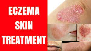 Best skin care in chennai. Best Skin Specialist Doctor In Deoria 91 8860455545 Especially For Skin Problem