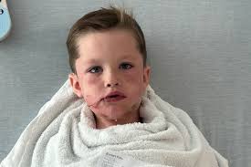 Fundraiser for Kirk Wahlen by Jordan Grieger : Support Hyrum's Journey to  Recovery