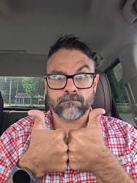 I'm double jointed and my thumbs do this~~~ From National geographic: Are  you double jointed? Your go-to party trick might amuse and entertain, but  it could be a lot worse for your