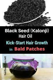 Usually it works by strengthening the hair roots, so improving the overall quality of your hair. Black Seed Kalonji Hair Oil Kick Start Hair Growth In Bald Patches Hair Oil Hair Loss Remedies Hair Loss Shampoo