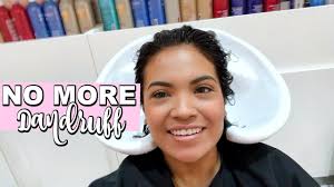 2 best haircut salons near me that open on sunday. Salon Hair Treatment For Severe Dandruff Belindaslife Youtube
