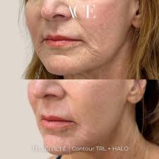 Kyndra Morris (@kyndra_pa.acemedspa) • Instagram photos and videos