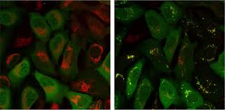 This common blood test measures the amount of various types of blood cells in a sample of your blood. Parkinson S Cancer And Type 2 Diabetes Share A Key Element That Drives Disease