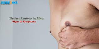 You can also call it a lump in breast. Breast Cancer In Men Signs Symptoms Medmonks