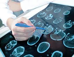What is Pediatric Neurology?