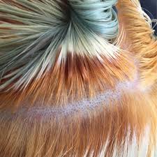 If you want to keep bleached hair healthy, it's a good idea to stick with lower level peroxide. What Would You Do From Level 1 To Level 10 Behindthechair Com