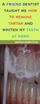 A Friend Dentist Taught Me How To Remove Tartar And Whiten My Teeth At Home Teeth Health Oral Care Oral Health Care