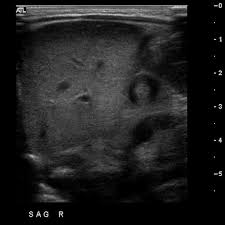 Radiology Quiz 8144 Radiopaedia Org Radiology Sonography Ultrasound Sonography