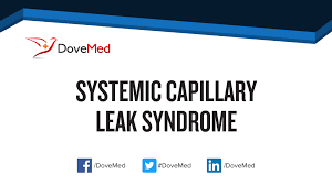 Sick building syndrom is a condition affecting office workers, typically marked by headaches and respiratory. Systemic Capillary Leak Syndrome