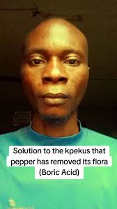 SOLUTION TO THE KPEKUS THAT PEPPER HAS REMOVED ITS FLORA, Like I said in  previous post how, parents do applied pepper into their daughter private  part in the name of punishment without the knowledge ...