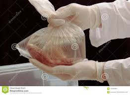 Георгий пинхасов / magnum photos. Chirurgie Des Greffes De Rein Transplantation Illegale Cadavre Humain Organe De Distributeur Dans Des Mains De Chirurgien Vacanc Image Stock Image Du Dans Rein 112004857