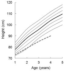 A Novel Mutation Of Exon 7 In Growth Hormone Receptor Mrna