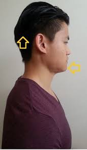Dowager S Hump Definition It Is An Enlarged Prominence That Is Formed At The Lower Region Of The Neck And Shoulder Exercises Neck Exercises Scoliosis Exercises
