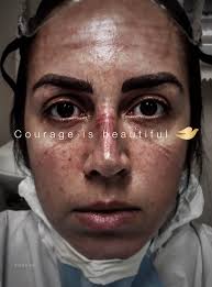 Title: Courage Is Beautiful Client: Dove Team: Ogilvy UK + Ogilvy Canada  Industry Craft: 🏆 1 GRAND PRIX 🥇 1 Gold More #ClientWork –>  https://okt.to/M3LKEU #CannesLions #CannesLions2021 #OgilvyCannes Cannes  Lions International Festival of Creativity