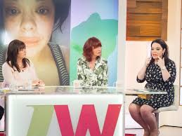 The truth about Lisa Riley's 'trout pout' lips!
