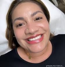 Your Local Tooth Fairy 🧚‍♂️🤍 (@pearlfectsmile_) • Instagram photos and  videos