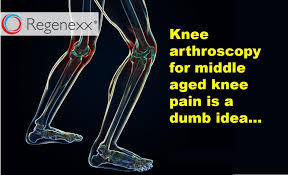 Knee Surgery For A Meniscus Tear Not If You Re Middle Aged