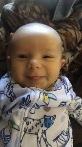 Happy Birthday, Kasen! He survived COVID and underwent a liver transplant  all before he turned ONE. Help us celebrate Kasen's first birthday! 🥳 (📸  Mitayah Donerlson) Read more about his journey here: