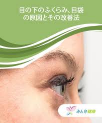 目の下のふくらみ 目袋の原因とその改善法 みんな健康 フェイスケア 顔ヨガ 目の下