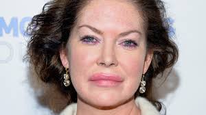 How Plastic Surgery Damaged Lara Flynn Boyle's Career