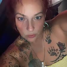 Hair falling out after bariatric surgery?