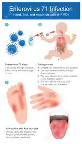 Pin On Microbiology Mnemonics