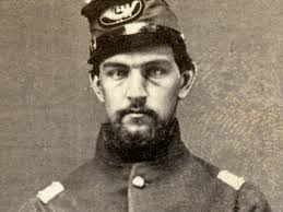 Ephraim Dawes survived a wound and reconstructive surgery