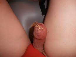 maggots foreskin - Creature Comforts | MOTHERLESS.COM ™