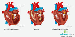 Find out more about the differences from a cardiac arrest often affects older people. Heart Failure Symptoms Causes Types And Treatment