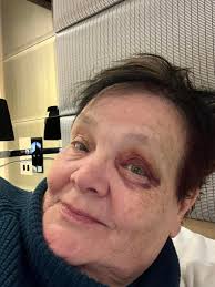 Just returned from “Gems of Southeast Europe “ with a pre trip to Vienna  and post trip to Romania 🇷🇴 last Friday. My daughter and I had a  wonderful time and made