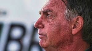 Politics: Brazil's ex-president Bolsonaro in hospital