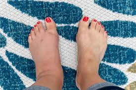 Image result for gout