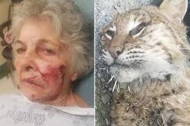 Officials state bobcat attacks on people are rare, and while we here at f.c. 80 Year Old Has No Time For Rabid Bobcat Why Is This Stupid Cat Attacking Me