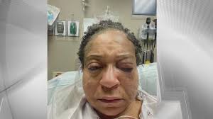 Woman attacked by stranger at San Francisco's Ocean Beach